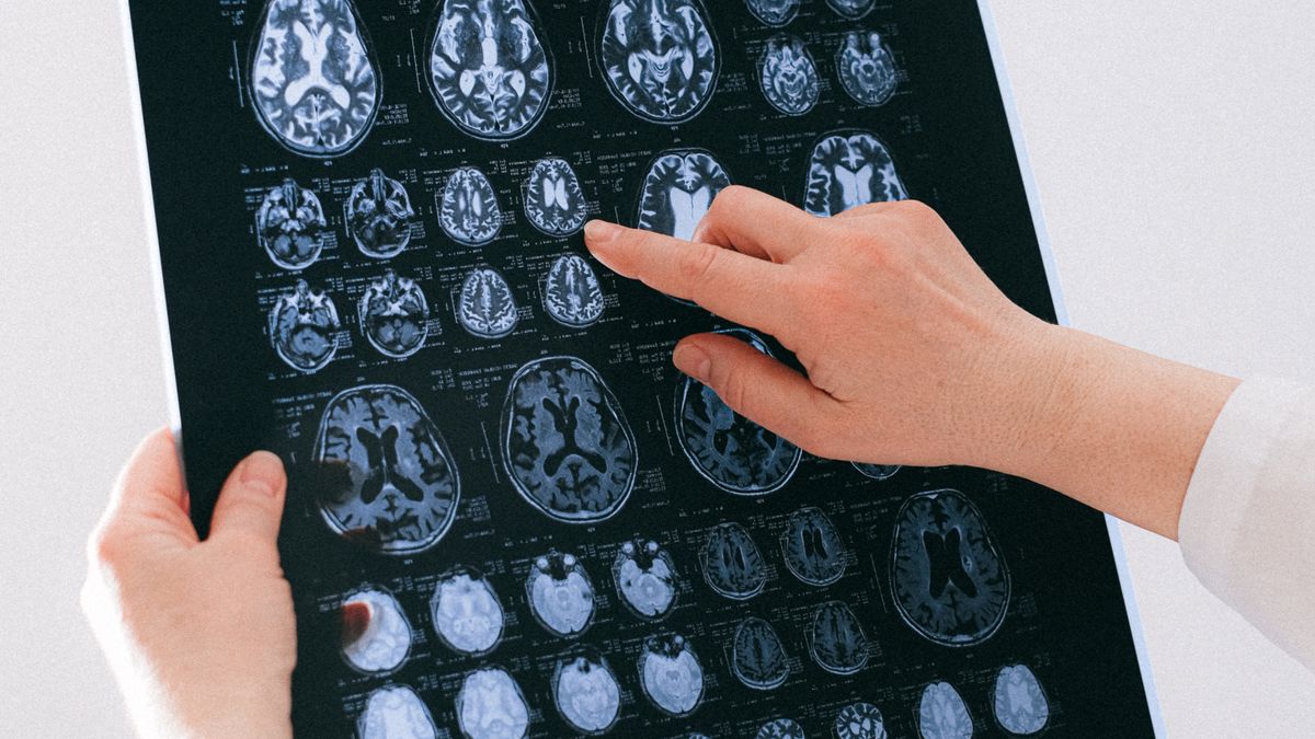 como seu cérebro aprende a sentir fome - neurociência do apetite